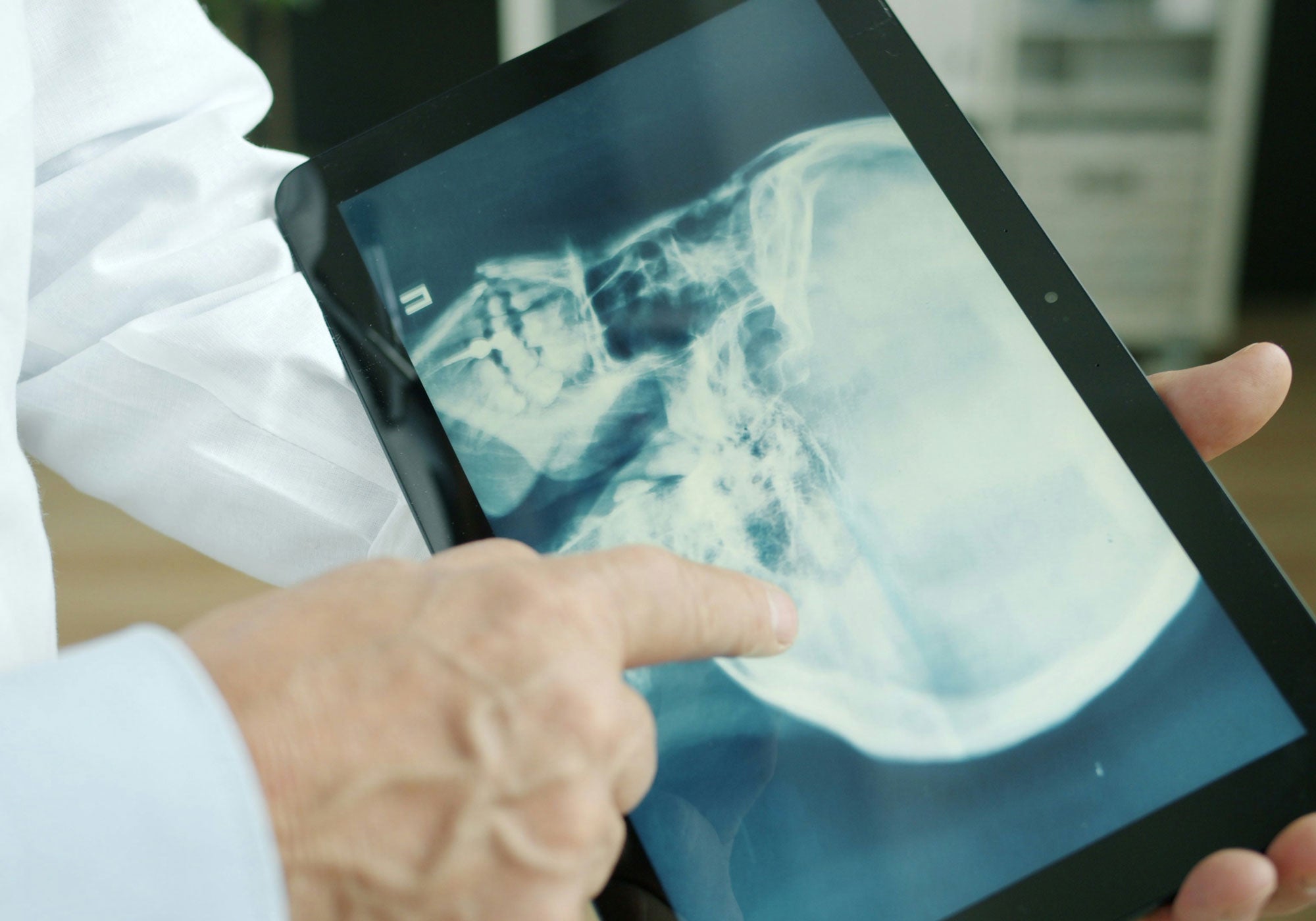 Person holding a tablet with an X-ray image on it, wearing a white coat.
